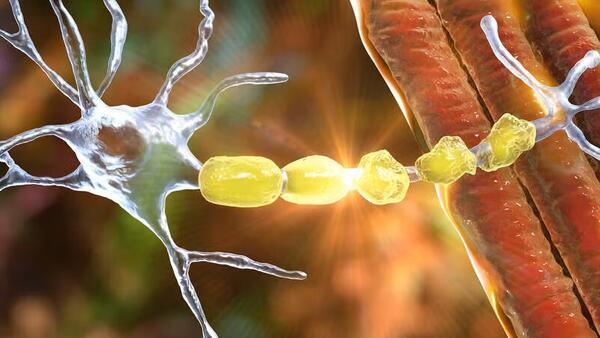 demyelination of neuron getty images demyelination of neuron getty images