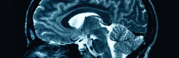 Brain Scan
