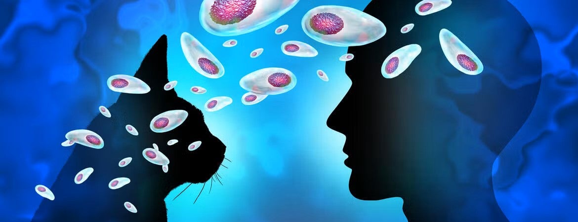 toxoplasma gondii getty images 